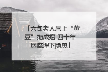 六旬老人唇上“黄豆”拖成癌 四十年烟瘾埋下隐患