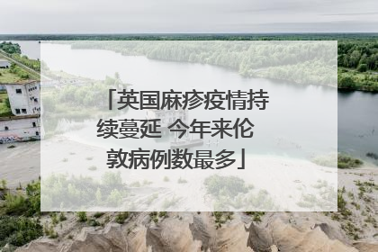 英国麻疹疫情持续蔓延 今年来伦敦病例数最多